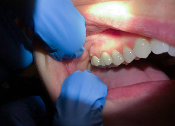 Professional Emergency Dental Service in AK